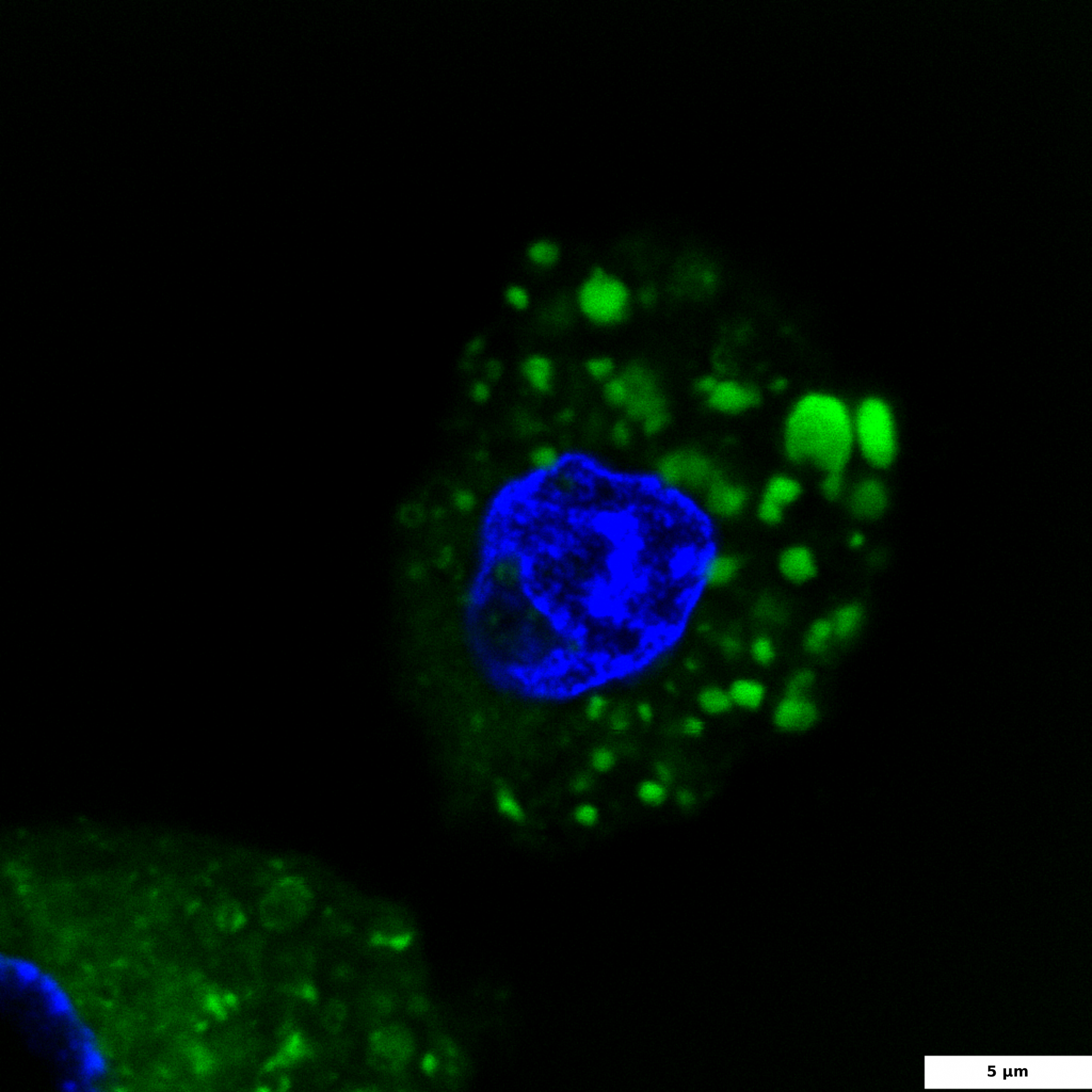 HepG2 cells treated with a mixture of free fatty acids, fixed and stained with BDP 493/503 (green) and DAPI (blue); 100x image