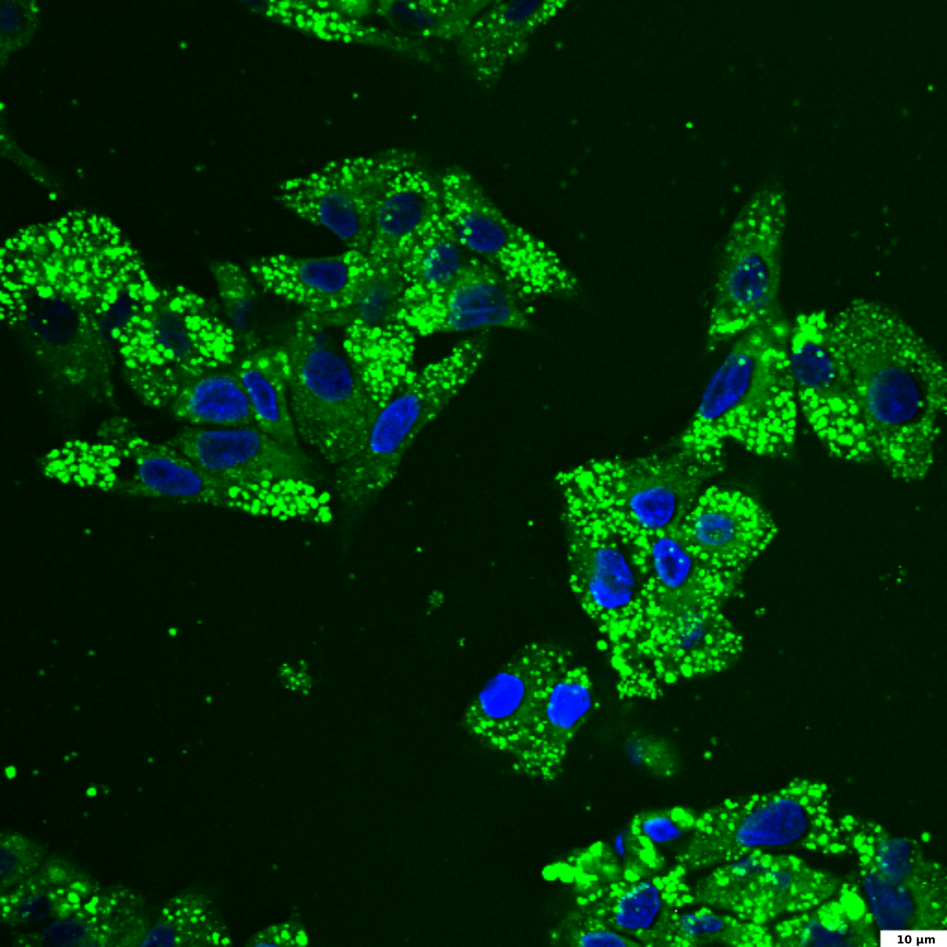 HepG2 cells treated with a mixture of free fatty acids, fixed and stained with BDP 493/503 (green) and DAPI (blue); 60x image